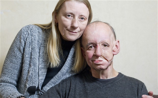 Impressão 3D dá cara a quem a perdeu