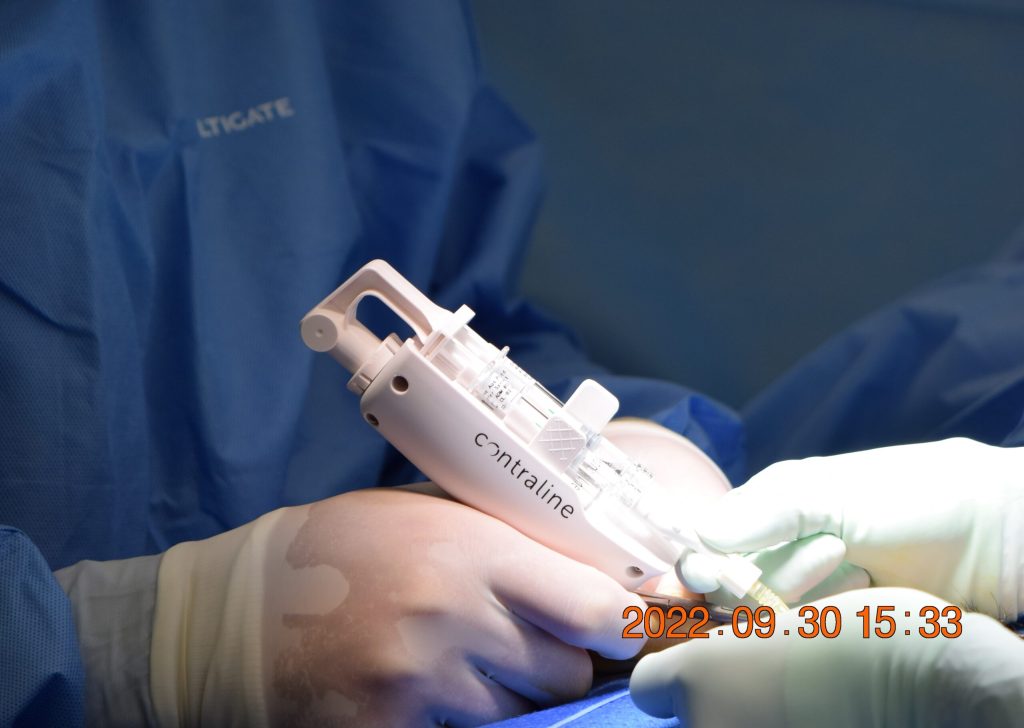 Contraline desenvolve contraceptivo masculino não invasivo e reversível 3 Contraline scaled 1