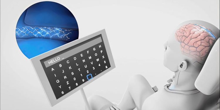 Implante cerebral controla a Amazon Alexa com o pensamento